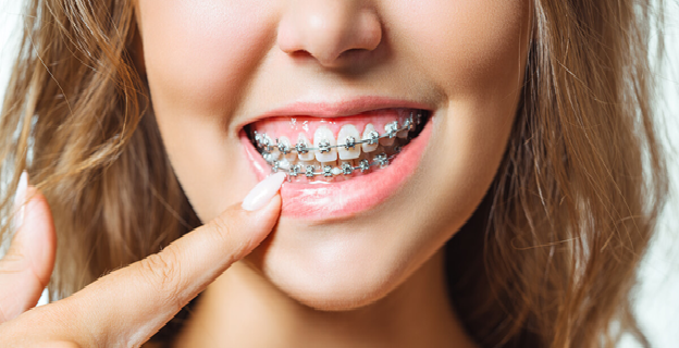 Common Risks of Orthodontic Treatment
