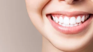 How to Prevent Possible Side Effects of Every Teeth Whitening Options