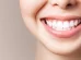 How to Prevent Possible Side Effects of Every Teeth Whitening Options